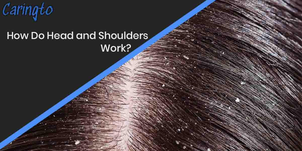 How Do Head and Shoulders Work