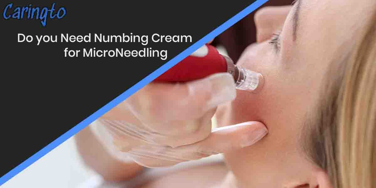 Do you Need Numbing Cream for MicroNeedling