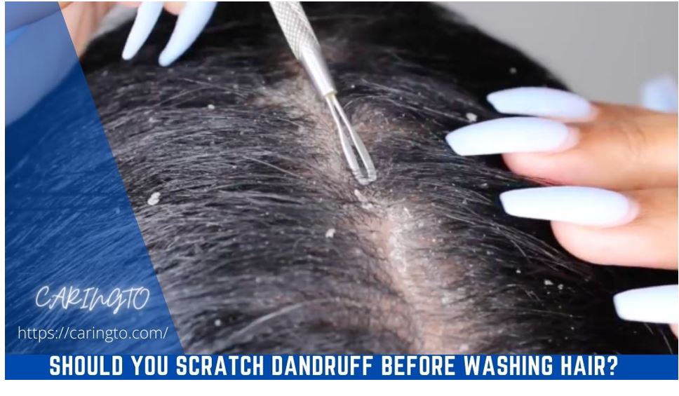 should-you-scratch-dandruff-before-washing-hair