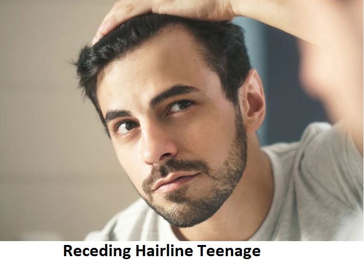 receding hairline teenage